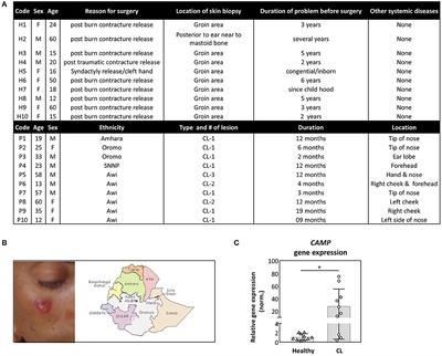 Cathelicidin Contributes to the Restriction of Leishmania in Human Host Macrophages